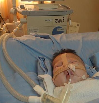 С���Ƴ���סԺ��Ҫ��ˮ����Һ,С����һЩˮ�ס�