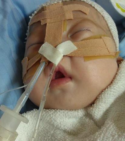 С��������֢�໤�����������ֺ�˯����.