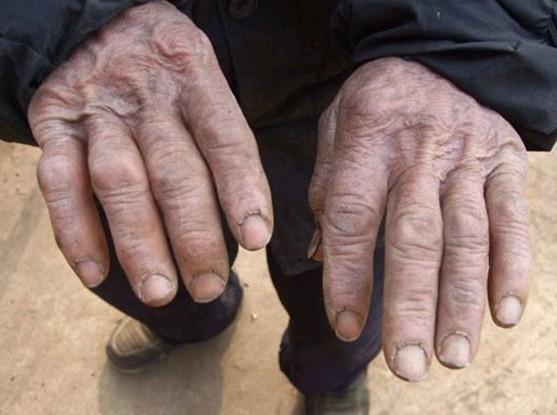 ���������˴ֲڵ�˫�֣�����������·����Ҫ�����ȡ�