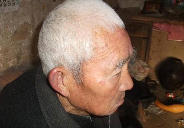 ���˵������򲡷�ˤ����һ��