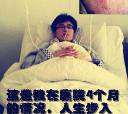 ��������ҽԺ4���µ�������Ͷ������������µİ̺ۡ�