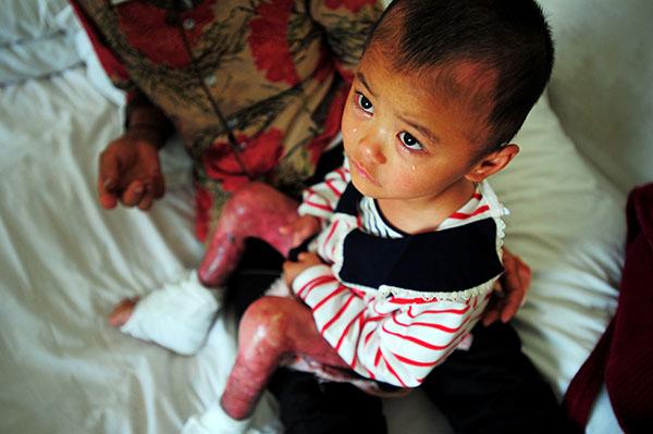 ����Ӣ: ����ҽԺ��û�д�λ������ӢƤ�������޷���˯�����ױ�������С�ù������������ⲽ...