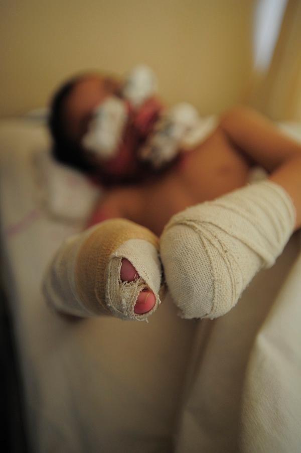 ����Σ��ֲ������������ʧȥ��9����ָ����������������ָʲôʱ���ܳ�������