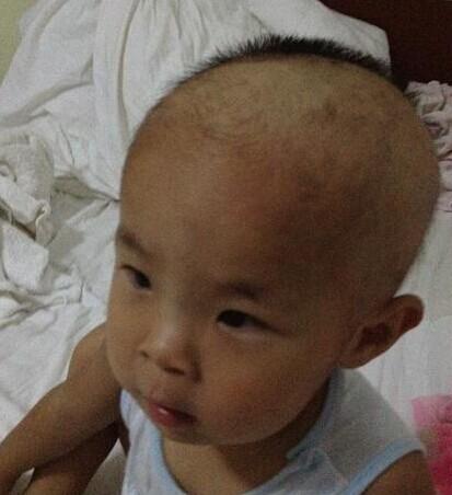 ���ƺ�ͷ�������ھ�ȫ������