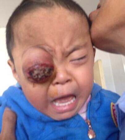 ����ǰ�����ĵ���Ƭ��2014��5��26�ţ��۾���λ����񻯣�����һֱ���ֲ�ͣ������˭�嶼�岻ס������̫������