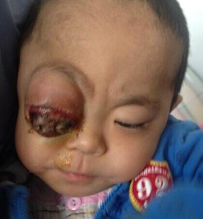 ����ǰ�����ĵ���Ƭ��2014��5��26�ţ����ѵð����Ĵ��ᣬÿ����ҩ����������ȥ�������Ѿ�׼��תԺ��