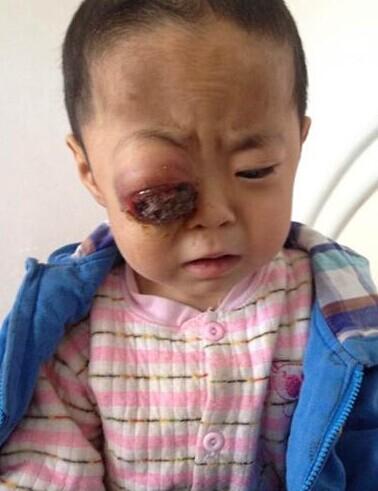 ����ǰ�����ĵ���Ƭ��2014��5��26�ţ������ĺ��ӣ���Ҫ���ͣ��۾���λһ���һ�����أ�ĸ�׵����������Ʒ���