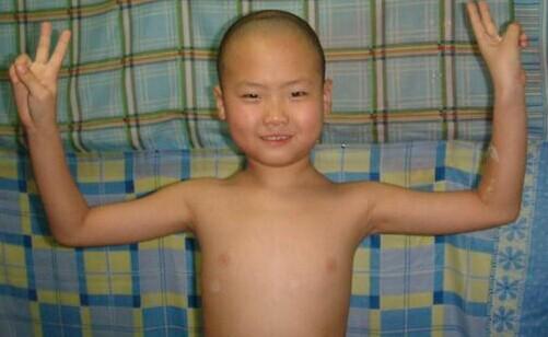 �ҴӼ�����ȥ�������������ҪסԺ�ˣ���һֱ�ȵ���������10������ý�������������յ���