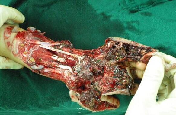 ���ǳ��µ���Ѫ��ģ�����֣�����ȫ�ǲ�м������޴������ˣ��粻�Ǵ��ҽ����տ��ҽ�¸�������ˡ�