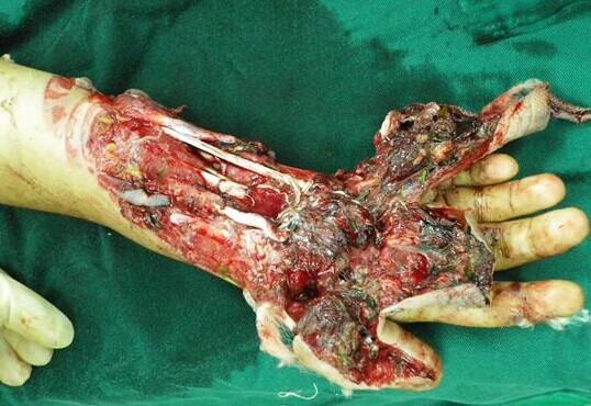 ����Ѫ��ģ�����֣����ǲҲ��̶á�