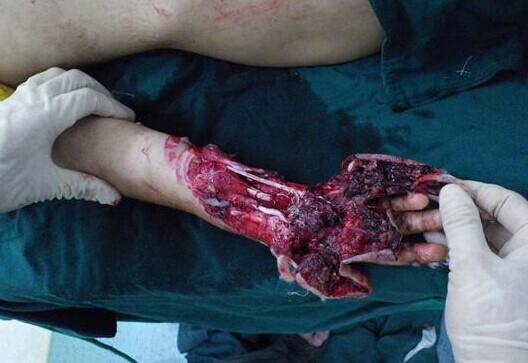 ����Ѫ��ģ�����֣����ǲҲ��̶á�