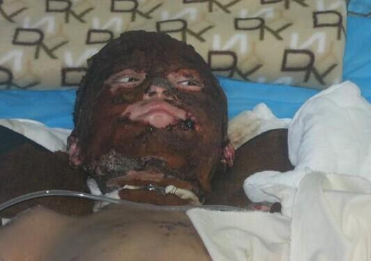 �����沿��������