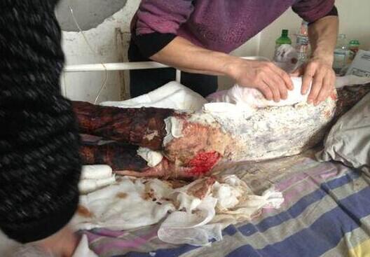 ���ӱ����Ѹ�Ⱦ��������ŧ