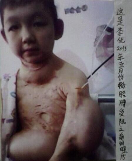 ��������ǰ����Ƭ