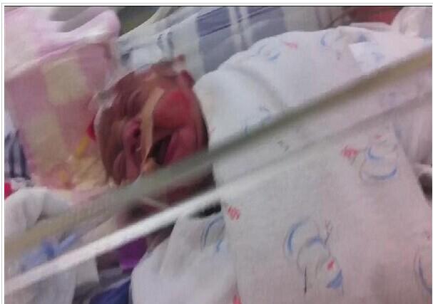 �������ܲ�ʹ����ĥ��