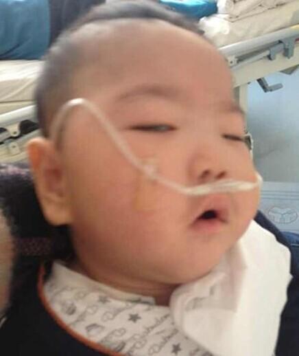 ����סԺ�����˶��㲲���