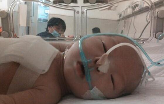 2012��1��1���Ͼ���ͯҽԺ�������Ī��������Ϊ�����µ�С����������������������Ϊ��������ICU����ס��ʮ��ת����ͨ��������Ƭ�����ڱ������ڣ����ű��ǹܣ������ܣ��Լ���ǰʮ�����ֳ��Ŀ��������˿ڣ�������С������ôС�;�����ô����������ˣ����˶��ѳ��ܣ�С���������̫�����ˣ�