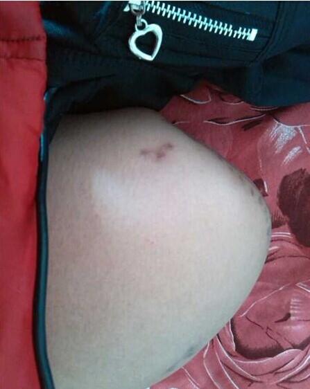 ��λ��֫�Ժ���ȡ�