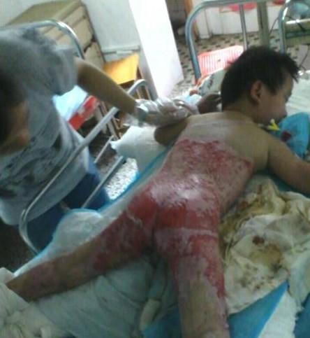 ������ÿ�λ�ҩ������ʹ����£�һ����ļ�п�������ҽ��˵�����Ѿ����ǿ�ˣ�������ʹ�ö���ޡ�