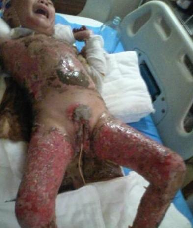 �����ڻ�ҩ���޵�˺���ѷΣ�����������ˣ�