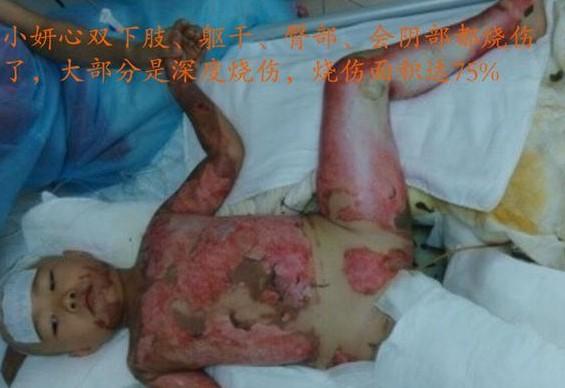 ���ź������������۰������Ӽ��ͣ����������ģ�