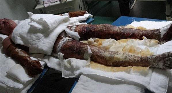 ���޻Ժ������ڼҿ�����һ����������2014��4��14�ռ����Ż����޻�Ϊ������һЩ���ж�������