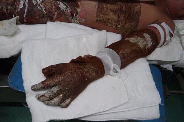 ���޻�ȫ��80%������ˣ������Ѿ�û��һ��õ�Ƥ��