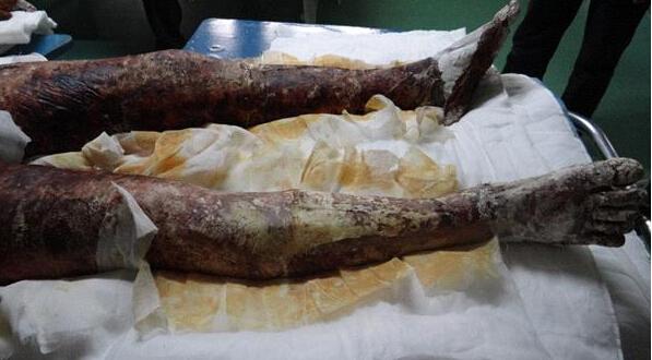 �°���û�Ҳ���һ����õ�Ƥ��