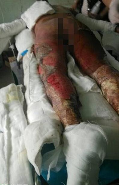 ���Ʒ��þ޴󣬼�ͥ����ά�����ƣ�����������Ԯ��