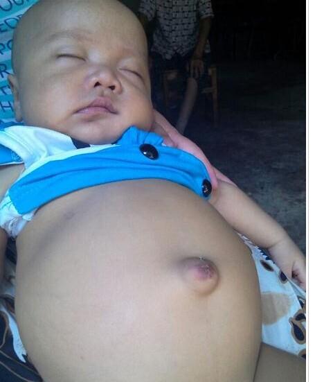 ��ûǮסԺ��С�㷫ƽʱֻ���ڼ���