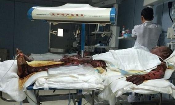 ��ϸ������Ƭ