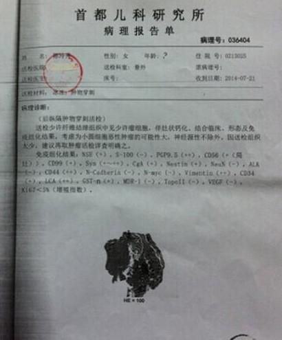 �����鱨��