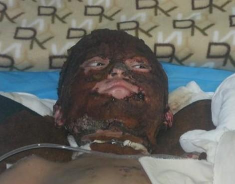 �����沿��������