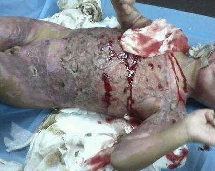 �ɳɲ���һ�����ͽ�����ȫ��40%��Ƥ�������ˡ�