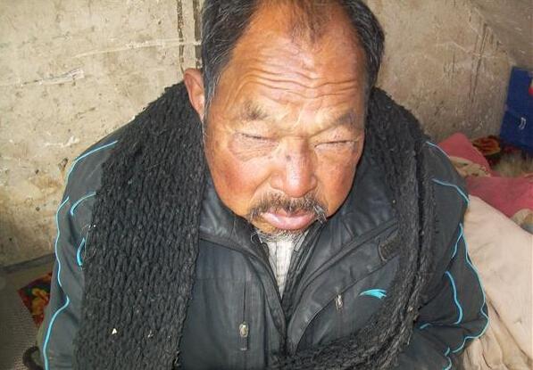 ������񼱣̫���˶��������������촽���࣬����������������ڿ϶��ܲ������