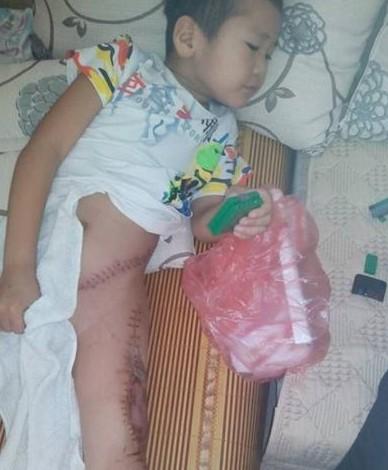 ����ȫ�������ɼ����˿ڣ�˺���ѷε�ʹ