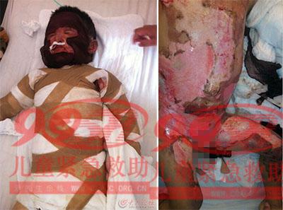 ������Ƭ