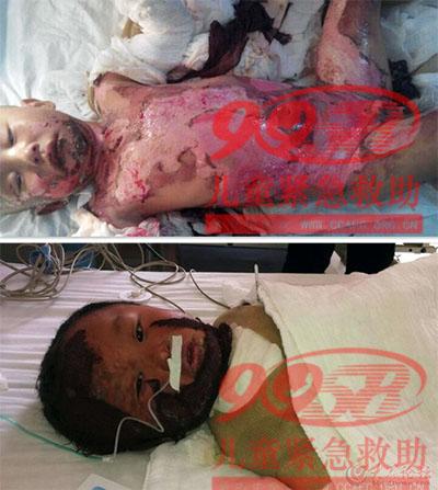 ������Ƭ