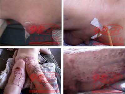 ������Ƭ