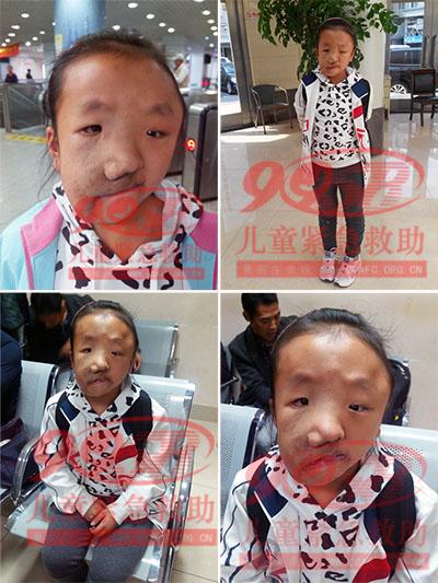 ������Ƭ