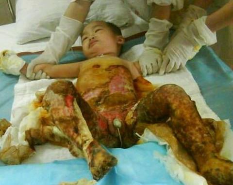 ���ǳɸ����˺��ڹ���ï������ҽԺ��ҩ����Ŀ���ĵ���Ƭ�����˿����޲�����