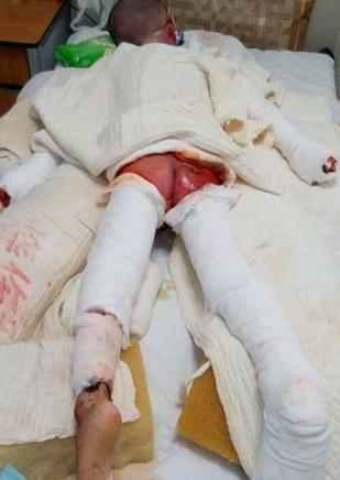 С����Ϊÿ��󲿷�ʱ�䶼�����ž�ʹſ�ڲ����ϡ�