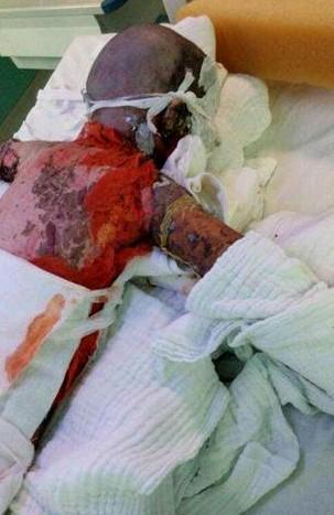 С����ȫ������û��������Ƥ����