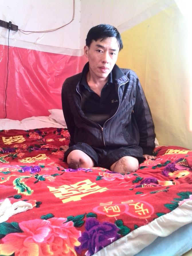 ˫�ȸ�λ��֫�ĸ���