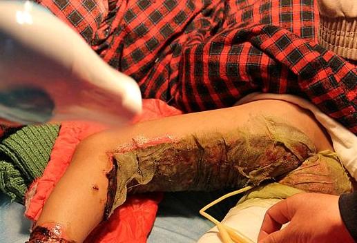 ����ҩ��Со��������ʹ����ֻ�����Ŵ����������ϣ��������㡣