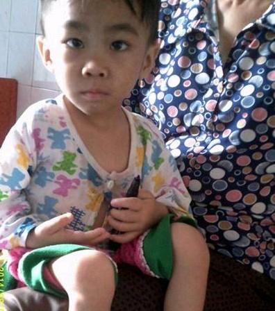 С����ɫ���ף�ҽ��˵��Σ��Ѫ����û�ˣ�����Ѫ�ͺúܶ��ˡ�