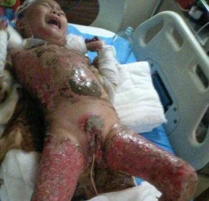 �����ڻ�ҩ���޵�˺���ѷΣ�����������ˣ�