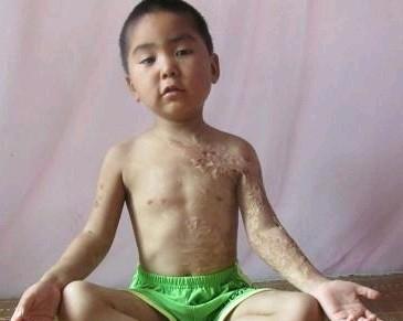 С�����Ƭ���Ѿ�Ӱ�췢������Ҫ������