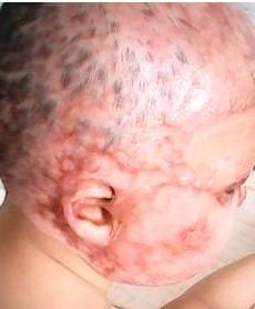 ë����ͷ���Ѿ����չ��ˣ��Ժ���Ҳ������ͷ����