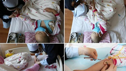 ҽ�����������������룬����Ѫ��ϸС��ÿ�ζ�������֫��Ѱ�Ҷ�βſ��Ҷ�λ�ã�����ȴ�ܵ�������ϡ�